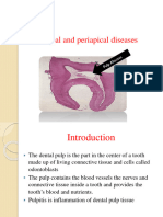 Pulpal and Periapical Diseases