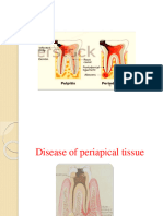 Periapical Diseases