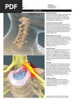 Folleto Dolor de Cuello