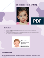 Hemifacial Microsomia