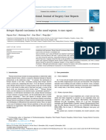 Ectopic Thyroid Carcinoma in The Nasal S 2024 International Journal of Surge