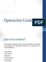 Operación Cesárea