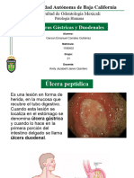 Ulceras Gastricas y Duodenales