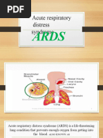 Acute Respiratory Distress Syndrome