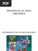 Patologia de Los Vasos Sanguineos