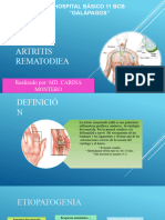 Artritis Rematoidea