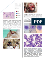 Neoplasias de Células Epiteliais