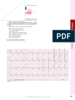 Atlas de Eletrocardiograma