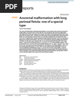 Anorectal Malformation With Long Perineal Fistula: One of A Special Type