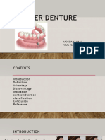 Final Over Denture