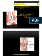 Acalasia-Eed