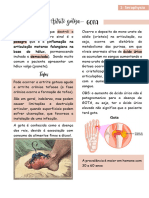 Artrite Gotosa