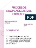 Procesos Neoplasicos Del Esofago