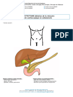 Fiche Ablation-Vesicule