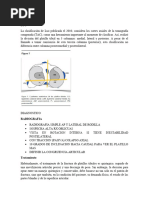 FX de Platillos Tibiales