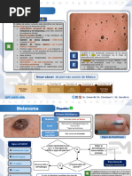 Melanoma