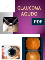 Glaucoma Agudo