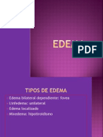 Edema