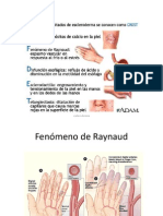 Esclerodermia