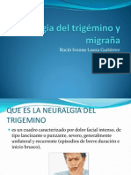 Neuralgia Del Trigémino y Migraña