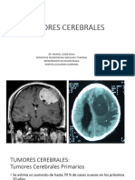 Tumores Cerebrales