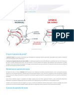 Apneia Do Sono - o Que É, Sintomas, Tratamento, Tem Cura?