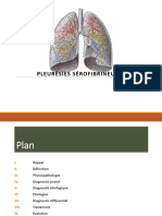 Pleurésies Sérofibrineuses