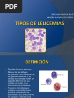 Leucemia y Cascada de Coagulación