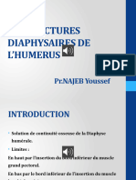 LES FRACTURES DIAPHYSAIRE DE L - HUMERUS 2020 Sonorise