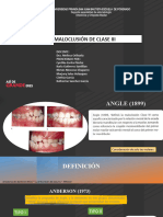 Maloclusion Clase III