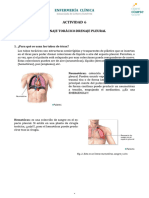 Actividad 6 - Drenaje Toracico