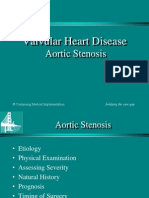 Valvular Heart Disease: Aortic Stenosis