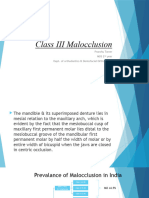 Class III Malocclusion