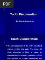 Tooth Discoloration