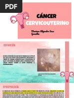 Cáncer Cervicouterino