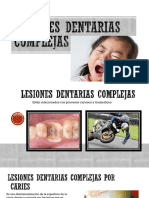 Lesiones Dentarias Complejas - SEPTIMO