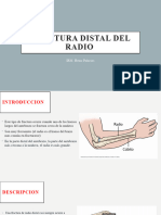 Fractura Distal de Radio