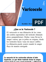 Varicocele Diapositivas