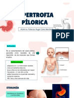 Hipertrofia de Piloro