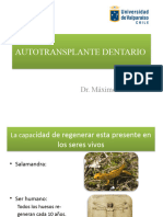 Autotrasplante Dentario