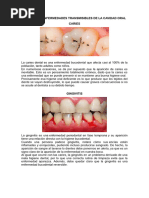 Asisntencia en Salud Bucal