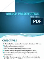 Breech Presentation