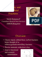 Maxillary and Periorbital Fractures: Satish Kumaran.P AMGH, Bangalore