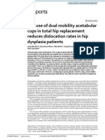 The Use of Dual Mobility Acetabular Cups in Total Hip Replacement Reduces Dislocation Rates in Hip Dysplasia Patients