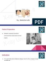 Mastoid View: Fig. - Mastoid Air Cells