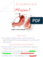 Peptic Ulcer