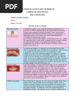 Lesiones Pulpares y Periodontales