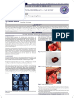 Pleomorphic Adenoma of The Soft Palate A Case Report - August - 2024 - 7502211214 - 5826776