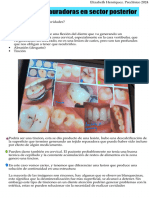 Técnicas Restauradoras en Sector Posterior