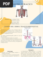 Trauma de Torax